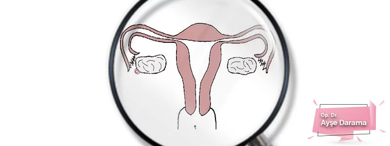 Obstetri ve Uterus İnversiyonu